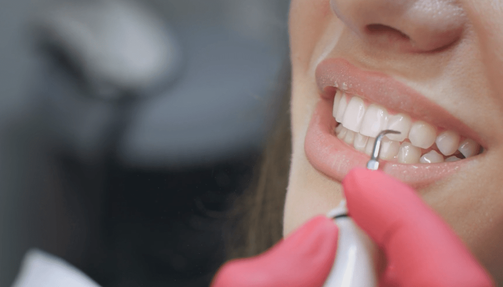 The De-evolution of the Hygiene&nbsp;Department